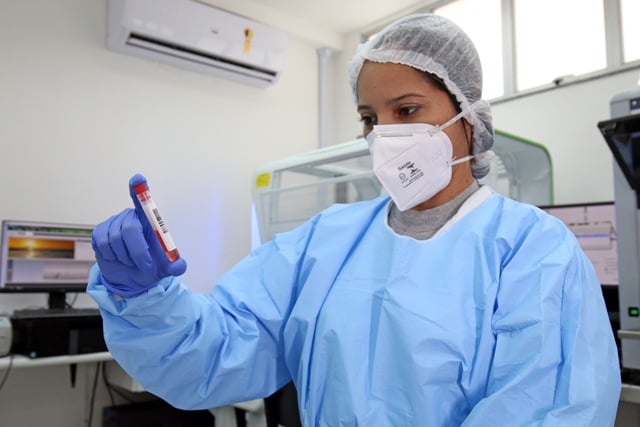 covid-19-exames-variantes-pandemia-foto-Leonardo-Rattes-sesab