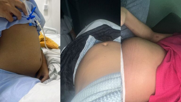 Lays-Oliveira-de-Jesus-endometriose-foto-reproducao-01