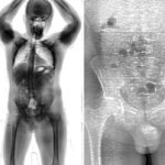 drogas-no-conjunto-penal-de-brumado-2