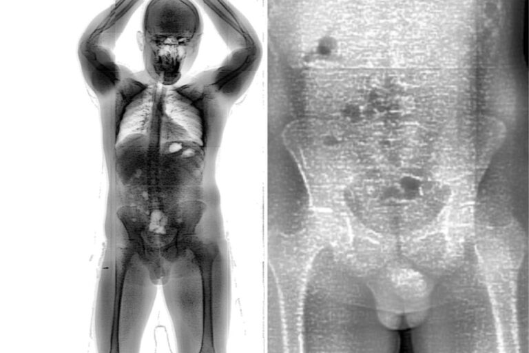 drogas-no-conjunto-penal-de-brumado-2