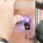 glaucoma-foto-cbo-divulgacao