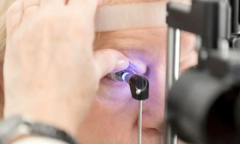 glaucoma-foto-cbo-divulgacao