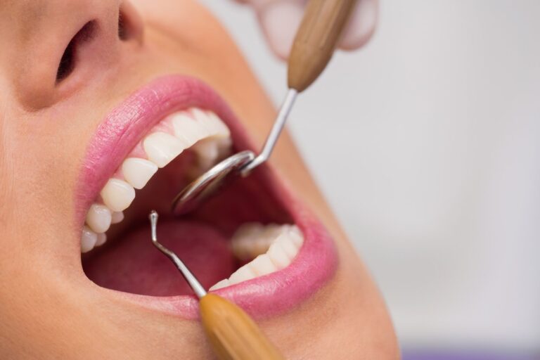 aparelho-dente-dentista-boca-foto-freepik