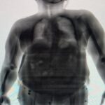 raio-x-mulher-tenta-entrar-com-drogas-no-presidio-foto-divulgacao-