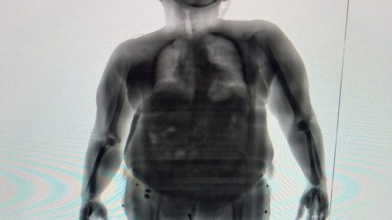 raio-x-mulher-tenta-entrar-com-drogas-no-presidio-foto-divulgacao-