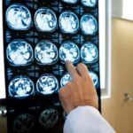 filme-de-raio-x-de-tomografia-computadorizada-de-cerebros_53876-464-freepik