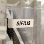 sifilis-