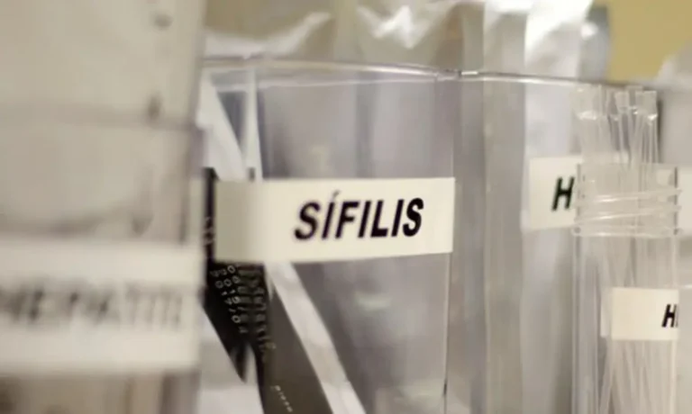 sifilis-