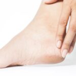 pe-pele-rachadura-cuidados-foto-divulgacao-