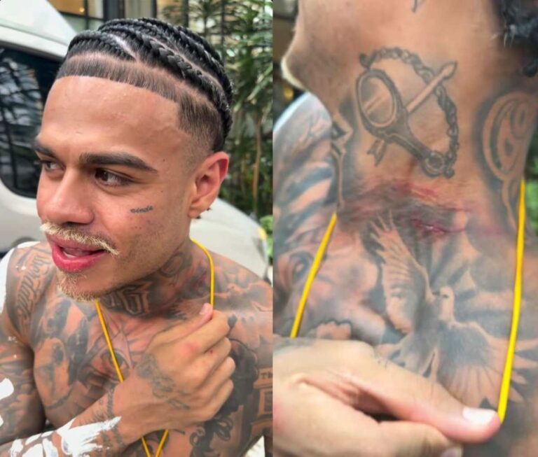 MC-Cabelinho-Fotos-Reproducao-Redes-Sociais-081225