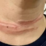 9689-achei-sudoeste-fio-solto-corta-pescoco-de-mulher-em-livramento-de-nossa-senhora