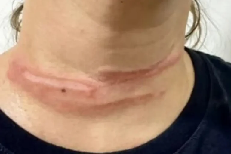 9689-achei-sudoeste-fio-solto-corta-pescoco-de-mulher-em-livramento-de-nossa-senhora