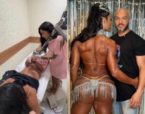 Gracyanne-Barbosa-inicia-remocao-de-tatuagem-intima-Fotos-Reproducao-Redes-Sociais-100226