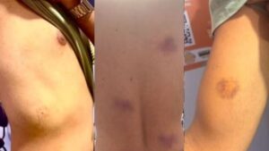 professor-Joao-Cruz-agredido-em-abordagem-policial-foto-reproducao-rede-Bahia-01