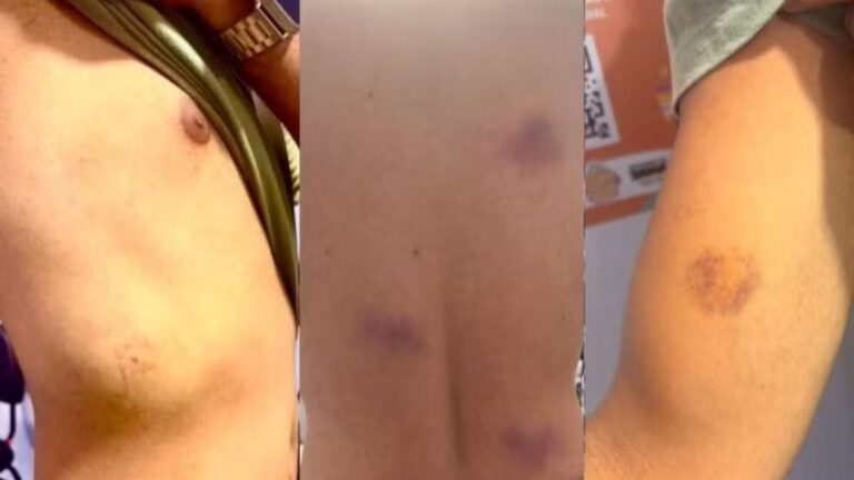 professor-Joao-Cruz-agredido-em-abordagem-policial-foto-reproducao-rede-Bahia-01