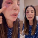 Ivete-Sangalo-Fotos-Reproducao-Redes-Sociais-030326