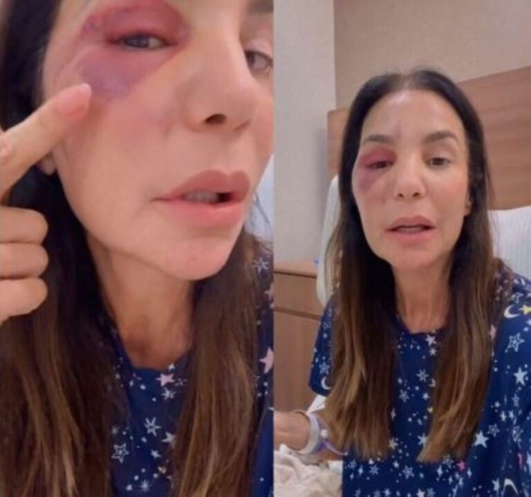 Ivete-Sangalo-Fotos-Reproducao-Redes-Sociais-030326