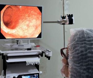 Mutirao-do-Marco-Azul-2026-Foto-Divulgacao-22-030326