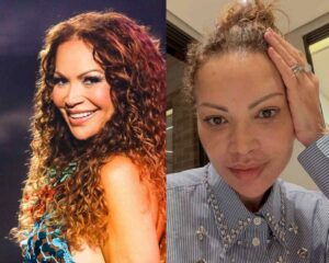 Solange-Almeida-antes-e-depois-dos-procedimentos-esteticos-Fotos-Reproducao-Redes-Sociais-130326