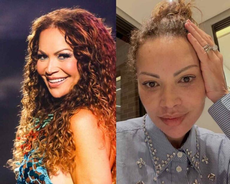 Solange-Almeida-antes-e-depois-dos-procedimentos-esteticos-Fotos-Reproducao-Redes-Sociais-130326