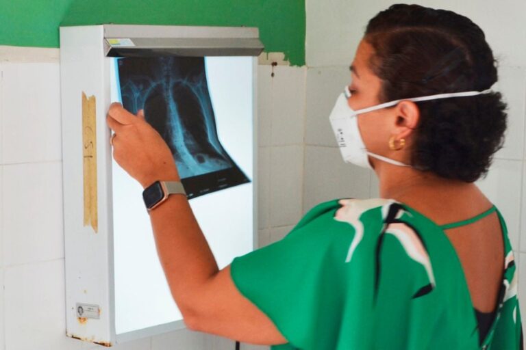 Tuberculose-Foto-Thiago-Paixao-1-1