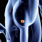 homem-masculino-corpo-prostata-foto-divulgacao-