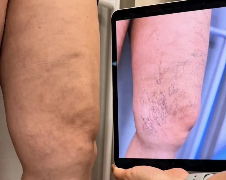 pernas-cansadas-release