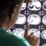 Doutor-vendo-exames-cerebrais-Foto-Reproducao-Freepik