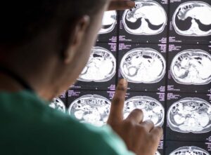 Doutor-vendo-exames-cerebrais-Foto-Reproducao-Freepik