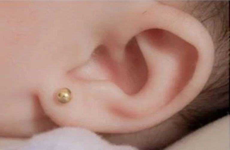 Furo-de-orelha-humanizado-Foto-Reproducao-iStock