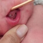 9183-bebe-nasce-com-dois-dentes-em-brumado