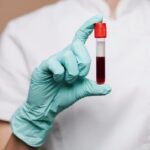 Exame-de-sangue-Foto-Reproducao-Freepik