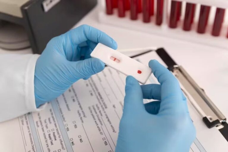 resultado-HIV