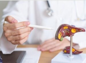Figado-hepatites-foto-ag-Einstein