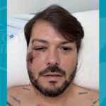 Prefeito-de-municipio-baiano-e-internado-apos-acidente-durante-trilha