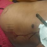 Homem-e-socorrido-com-faca-cravada-no-corpo-em-Gongogi-Foto-Reproducao-Redes-sociais-