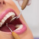 aparelho-dente-dentista-boca-foto-freepik