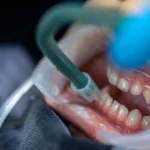 dentes-
