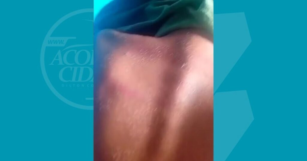 Professor-e-denunciado-por-agredir-crianca-de-8-anos-com-cipo-de-goiabeira-Foto-Reproducao-Redes-Sociais