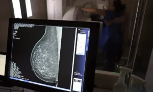 mamografia-
