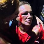 Vereadora-do-PT-fica-ferida-no-rosto-apos-agressao-durante-manifestacao-em-MG-foto-reproducao-