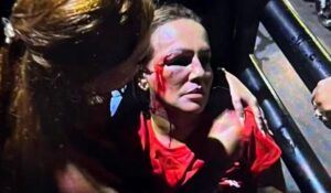 Vereadora-do-PT-fica-ferida-no-rosto-apos-agressao-durante-manifestacao-em-MG-foto-reproducao-