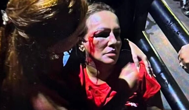 Vereadora-do-PT-fica-ferida-no-rosto-apos-agressao-durante-manifestacao-em-MG-foto-reproducao-