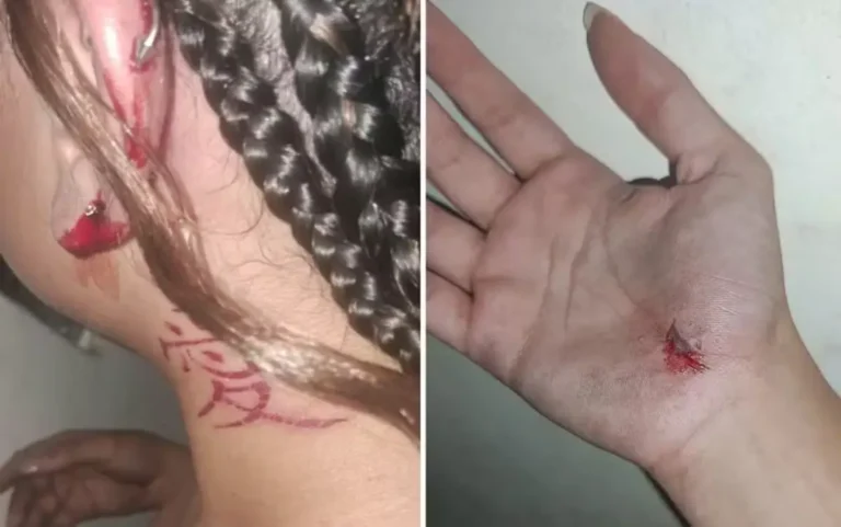 agressao-estudante-comemoracao-de-Lula