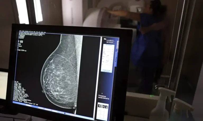 mamografia-