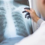 radiografia